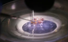 Kene vakalarında artış neden yaşanıyor? uzmandan kritik uyarılar